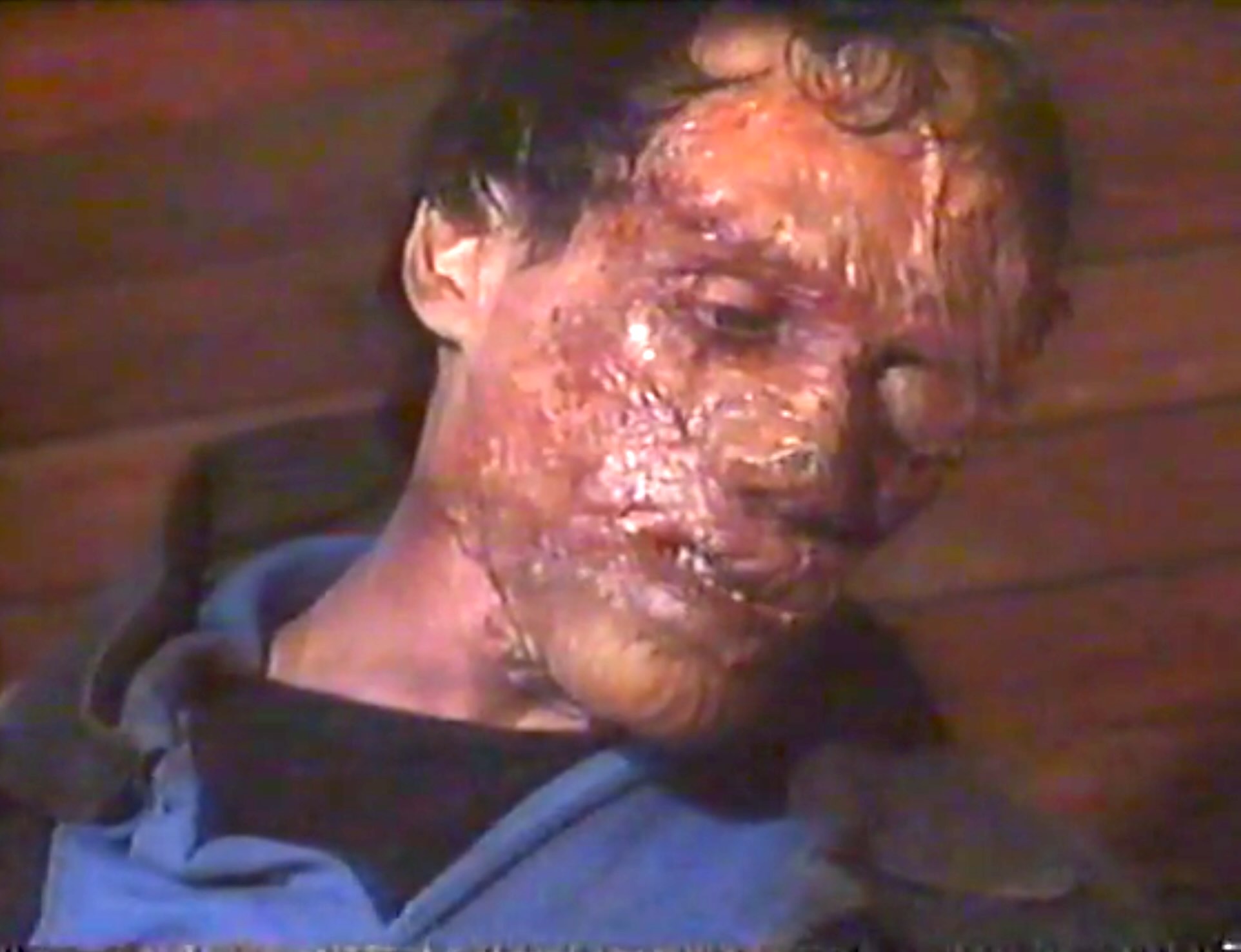 Charly: Days of Blood (1990)